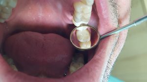 20160624_185249 (Medium)