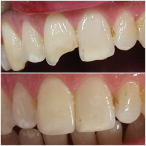 20170531_211818 (Medium)