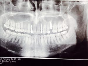 FullSizeRender (Medium)