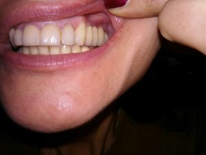 IMG_3416 (Medium)