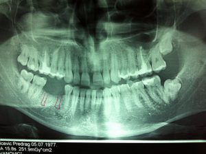 photo 1 (Copy)