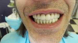 20160613_161156 (Medium)