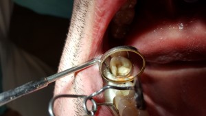 20160624_180606 (Medium)
