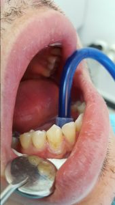 20160705_142757 (Medium)