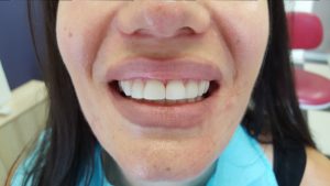 20160706_163516 (Medium)
