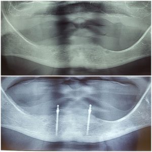 20170516_134427 (Medium)