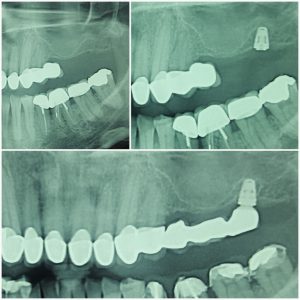 20170517_173411 (Medium)