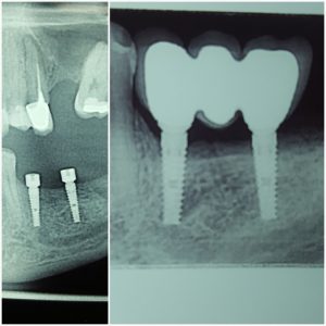 20170817_021014 (Medium)