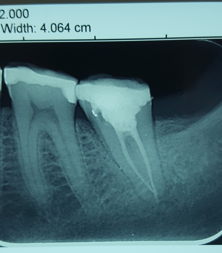 20180604_122357 (Medium)